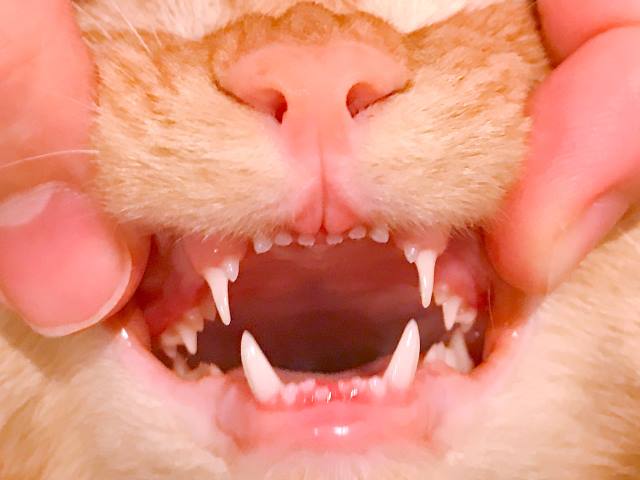 陽ちゃんの歯