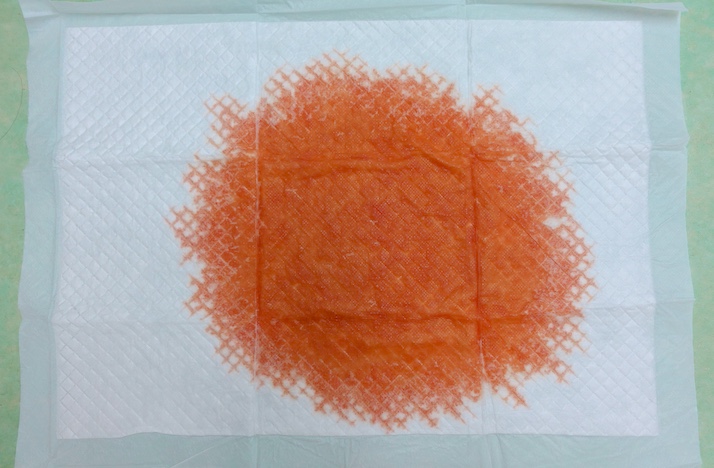 黄疸尿