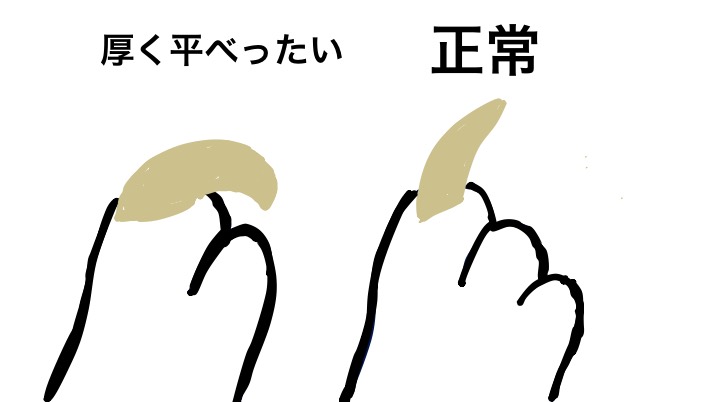 爪の比較