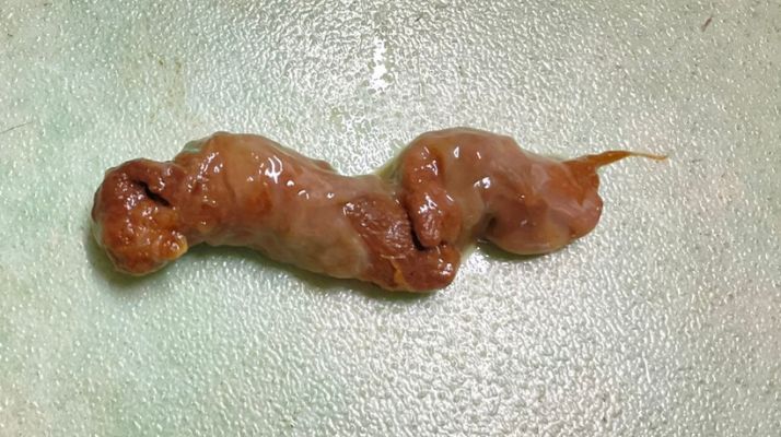 表面に粘膜が付着した便